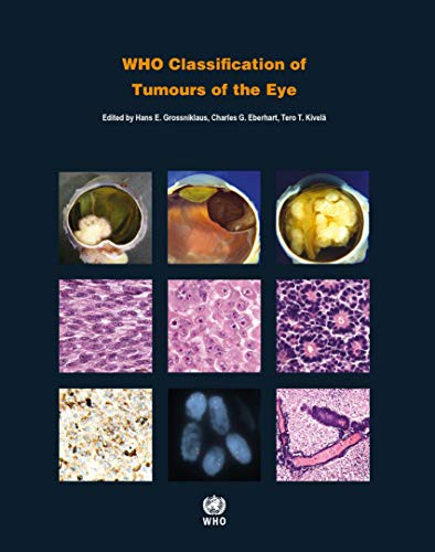 WHO Classification of Tumours Editorial Board, C. Eberhart, T. Kivela: WHO Classification of Tumours of the Eye (Paperback, 2018, World Health Organization)