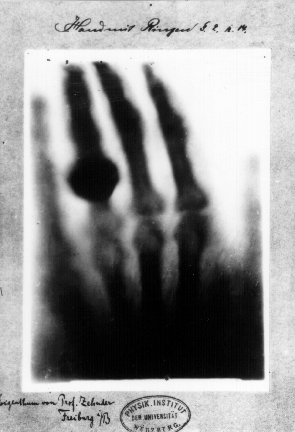 Hand mit Ringen (Hand with Rings): a print of one of the first X-rays by Wilhelm Röntgen (1845–1923) of the left hand of his wife Anna Bertha Ludwig. 

It was presented to Professor Ludwig Zehnder of the Physik Institut, University of Freiburg, on 1 January 1896.